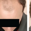 Top Hairstyles for Thinning Hair